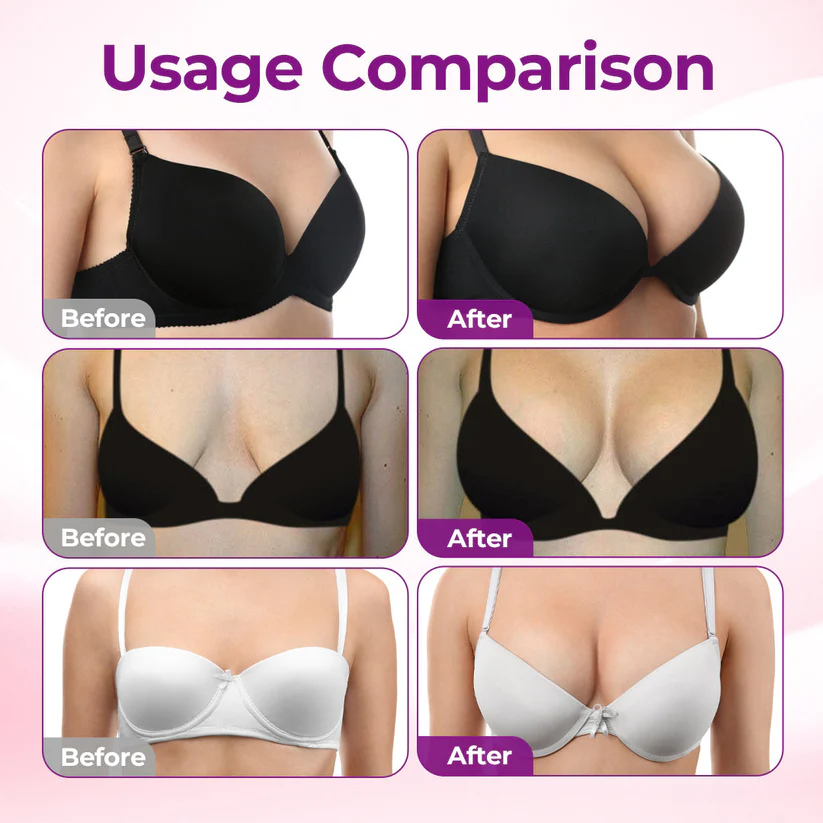 🔥Ends Tonight: 50% OFF🔥NATRAVOR® Targeted Breast Enhancement Advanced Nano Microneedle Patch