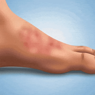 NATRAVOR® Antifungal Soap