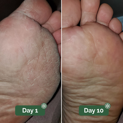 NATRAVOR® Antifungal Soap