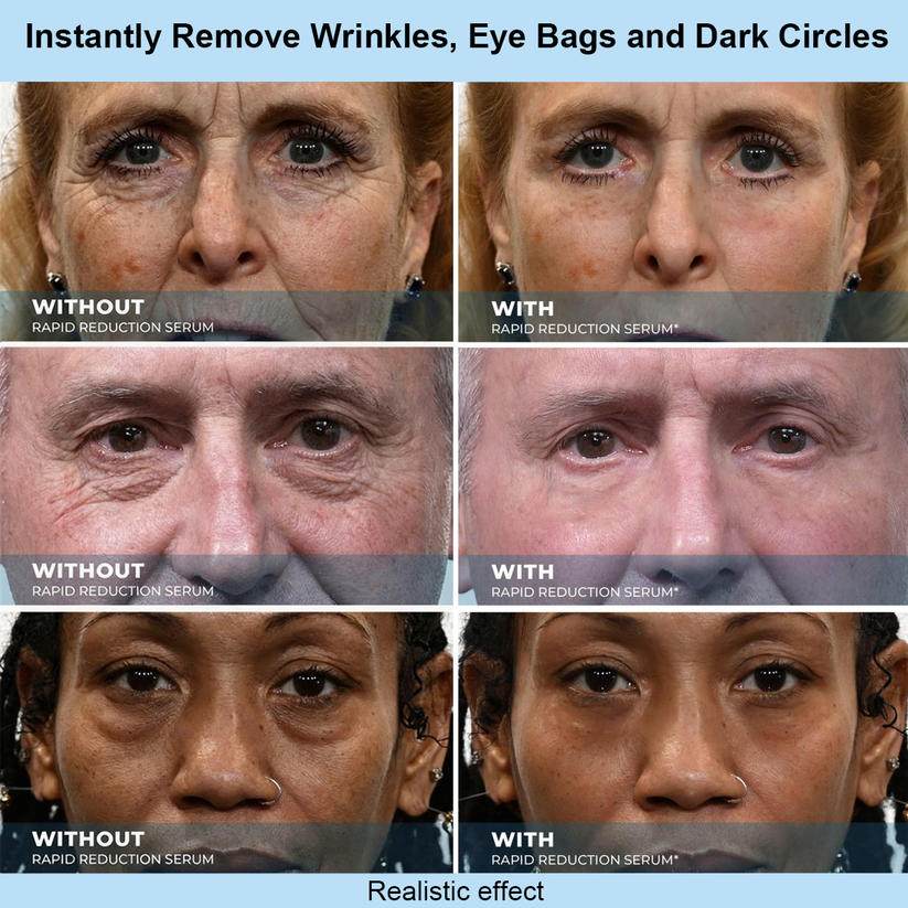 Luxloe™ Instant Face Temporary Tightener – Instant visible results in 30 seconds